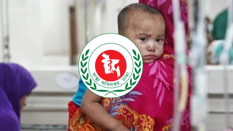 হাম উপসর্গে আরও ৭ শিশুর মৃত্যু